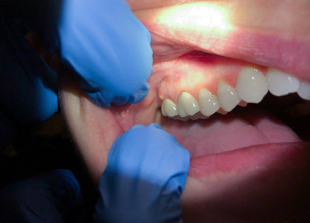 Best After-Hours Emergency Dentist in Baxter, MN