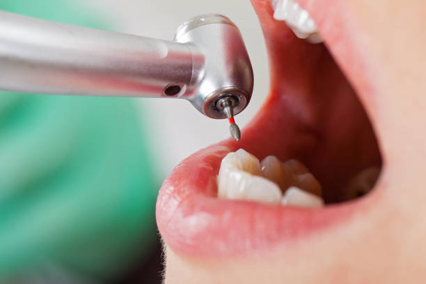 Best Pediatric Emergency Dentist in Baxter, MN